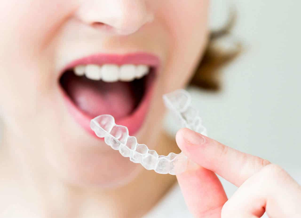 Invisalign-aligner-removal-phoenix Invisalign-aligner-removal-phoenix