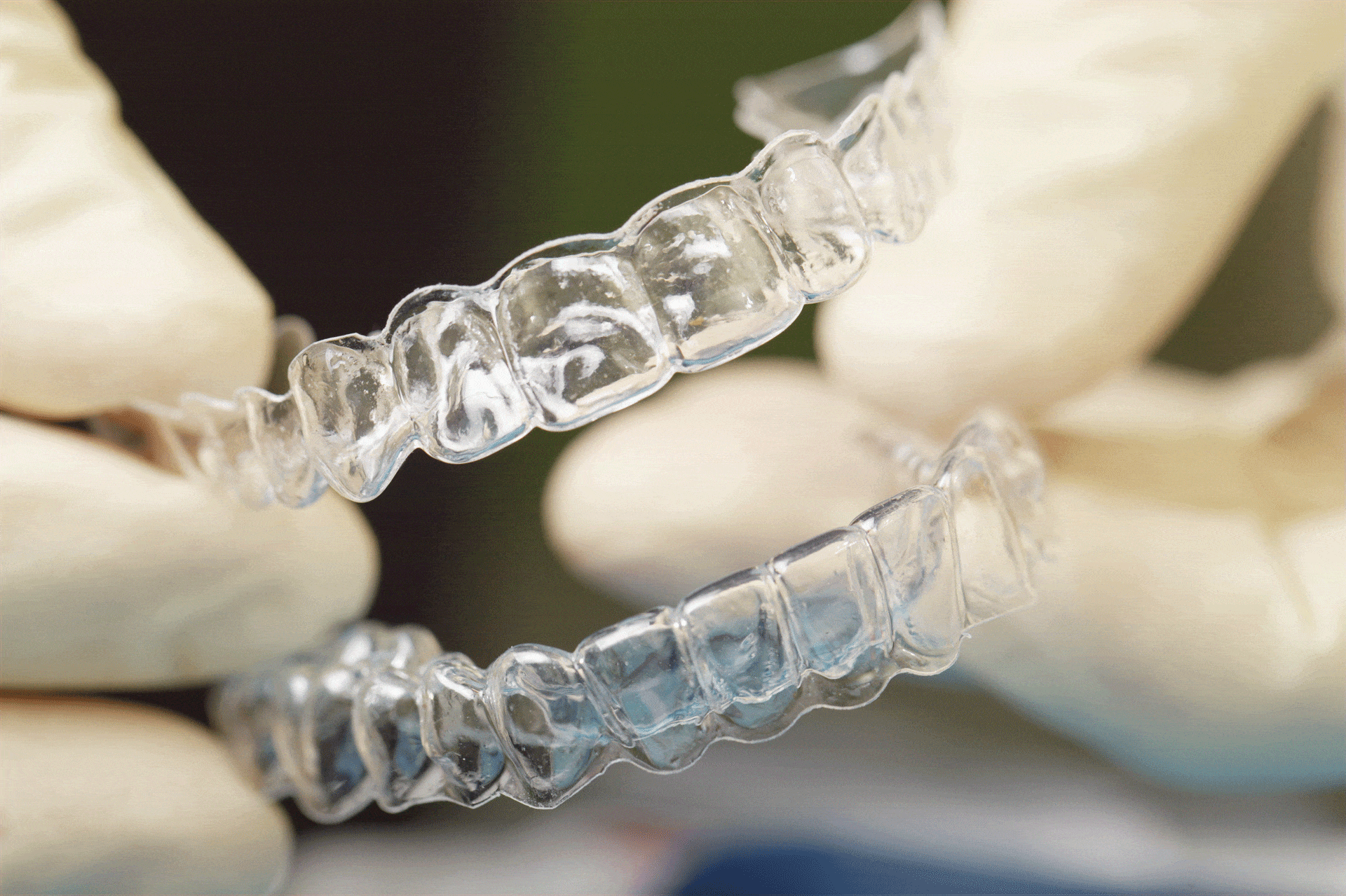 removable-vs-permanent-retainers-which-is-right-for-you